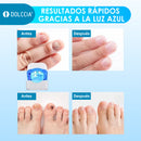 Hongomax™ Tratamiento Láser para Restaurar Uñas